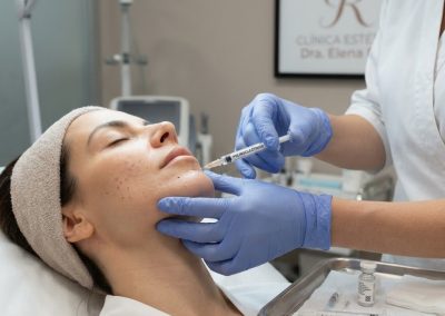 Tratamiento facial con Polinucleótidos