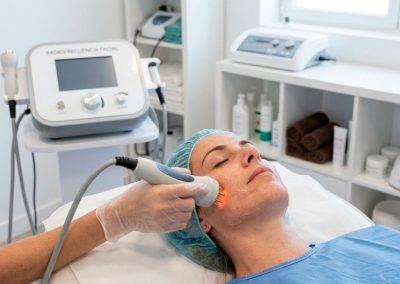 Radiofrecuencia Facial y Corporal
